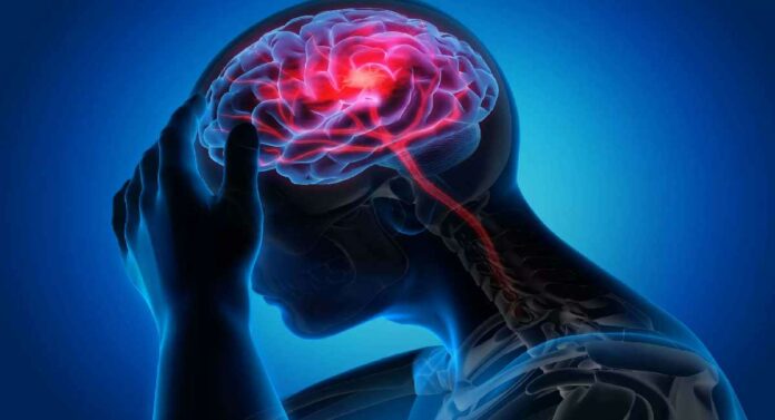 Brain Stroke : पक्षाघात झालेल्या महिलेला यशस्वी उपचाराअंती मिळाले नवे जीवनदान