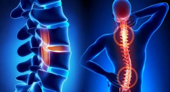 Spinal Disorders : पालिकेच्या 'या' रुग्णालयात मणक्याच्या विकारांवर मोफत शस्त्रक्रिया