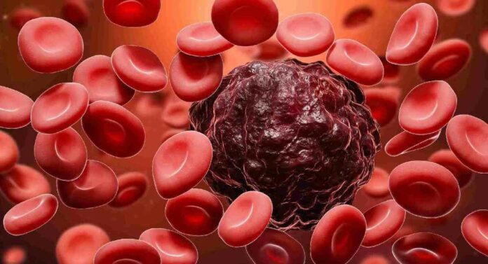 Blood Cancer च्या सुरूवातीला दिसणारे 'हे' एक साधे पण महाभयंकर लक्षण तोंडपाठ कराच