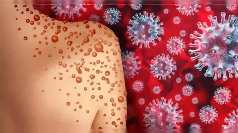 Monkeypox virus मुळे राज्य सरकारच्या आरोग्य विभागाला महत्त्वाच्या सूचना